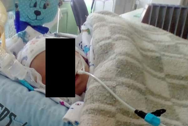 Семилетней девочке сломали череп в кафе на ее день рождения