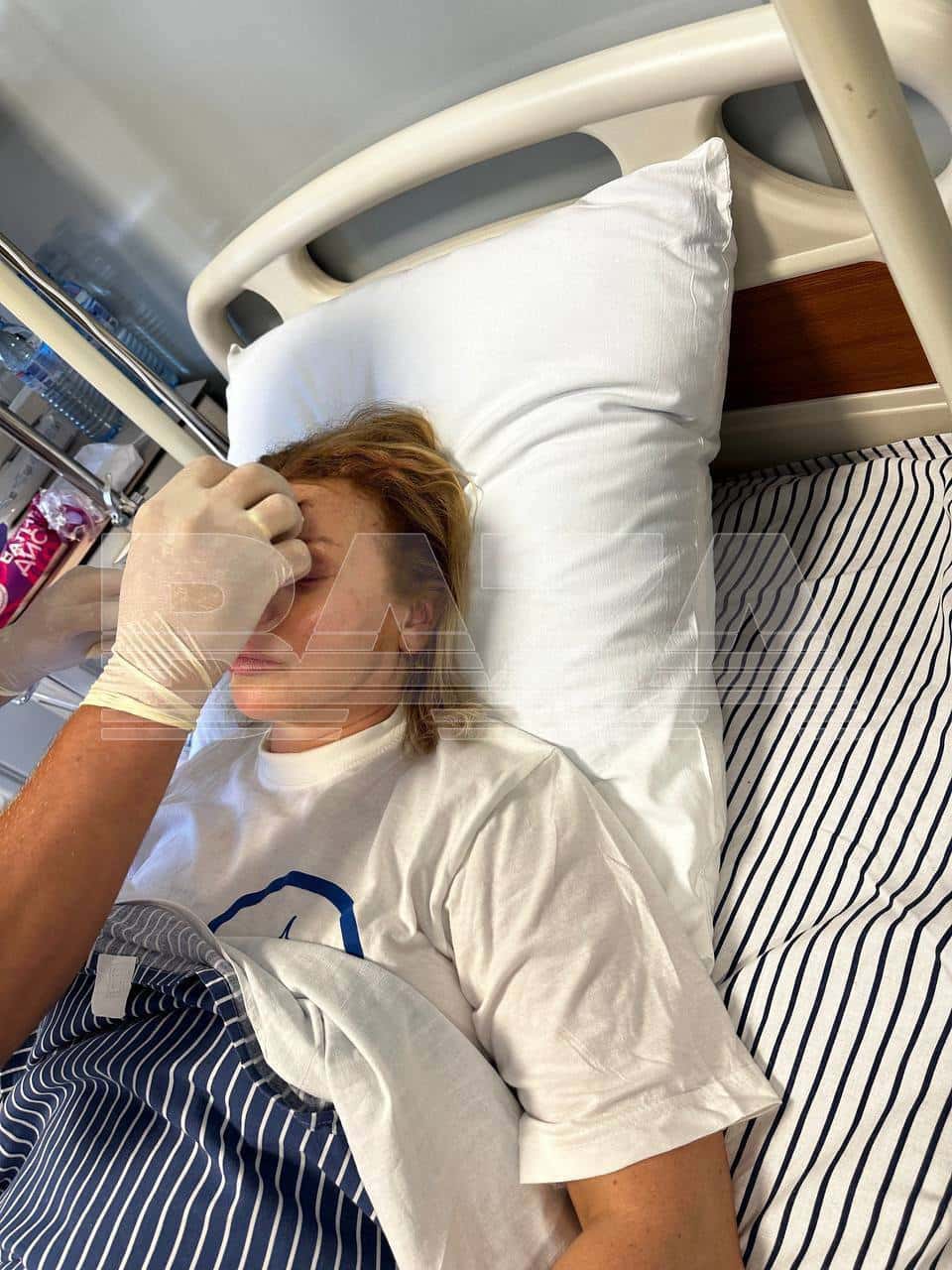 Появились первые фото Лады Дэнс после страшной аварии