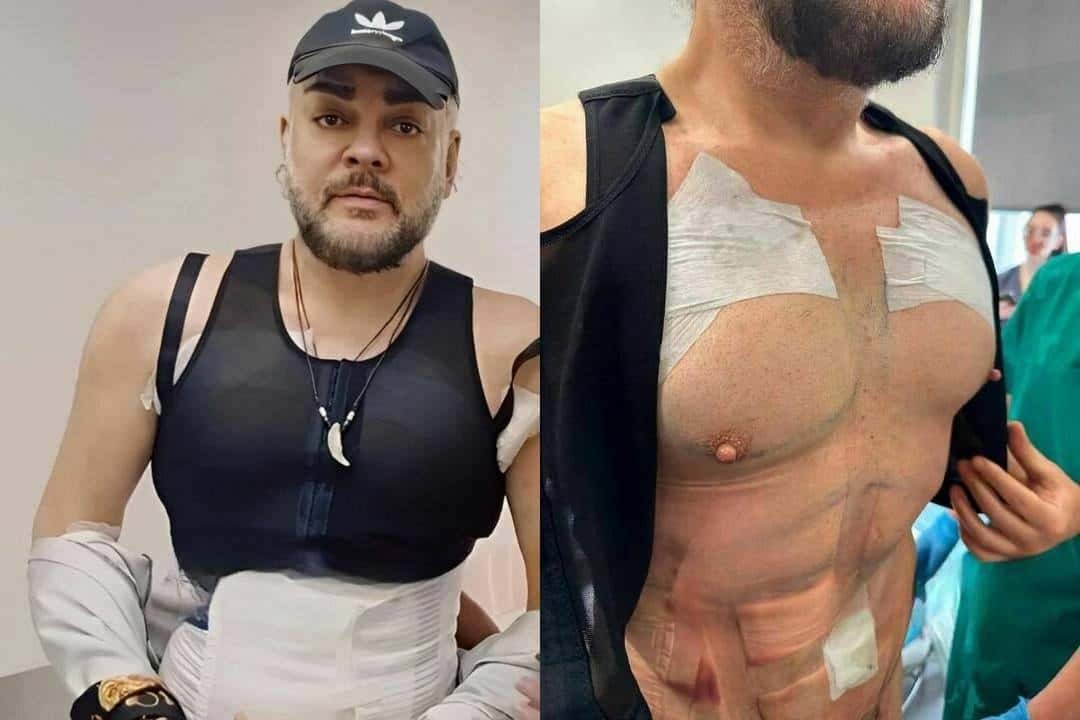 Звёздный хирург Хайдаров признался, что фанаты хотели выкупить жир и плоть Киркорова