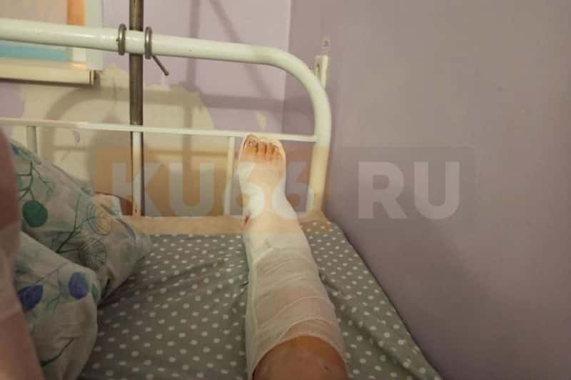 «Мужчины проходили мимо, пенсионерки помогли»: жительница Каменска-Уральского получила сложный перелом