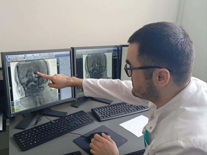 Как врачи Каменска-Уральского спасают пациентов от инсульта: новая технология удаления тромбов