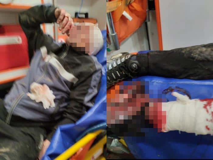 «Они начали рвать мужа»: в Каменске-Уральском стаффорд и шарпей чуть не загрызли человека, их хозяйка скрылась