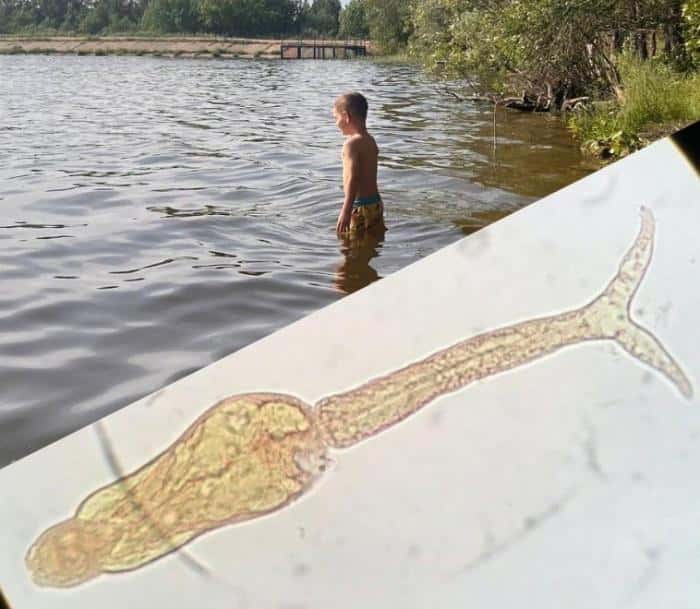 «В кожу въелся паразит»: малышка покрылась сыпью после купания в уральском водоеме