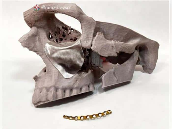 Как свердловские врачи спасли военнослужащего: уникальная операция после ранения на СВО. Фото