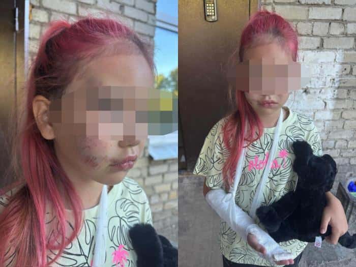 «Воспитатель сидела на лавочке»: девочка получила перелом и сотрясение в лагере «У Трёх Пещер» под Каменском-Уральским