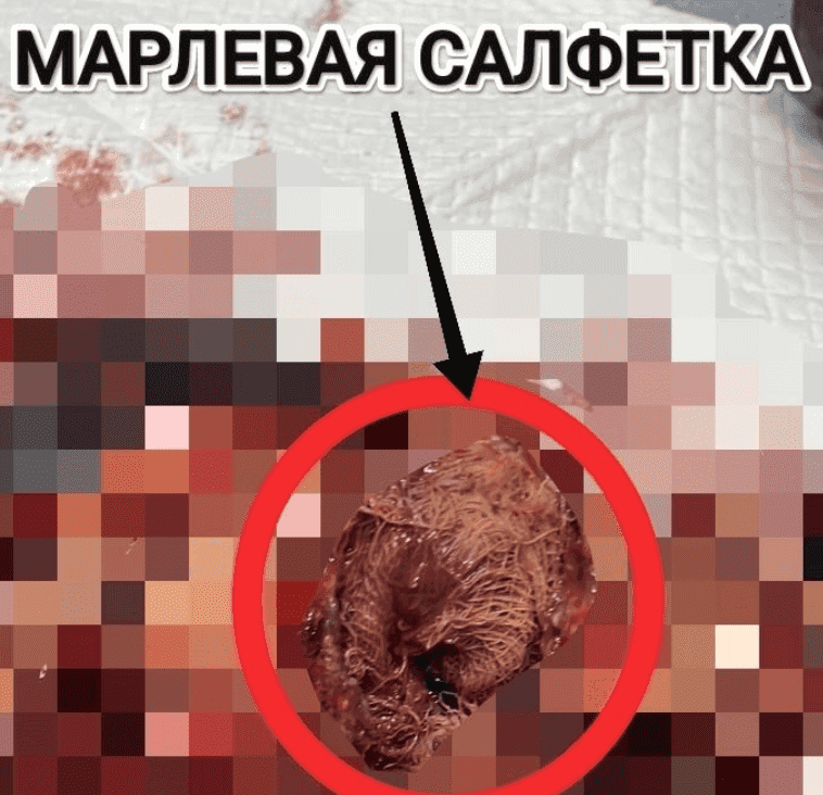 В Каменске-Уральском собака чуть не погибла из-за забытой салфетки после стерилизации