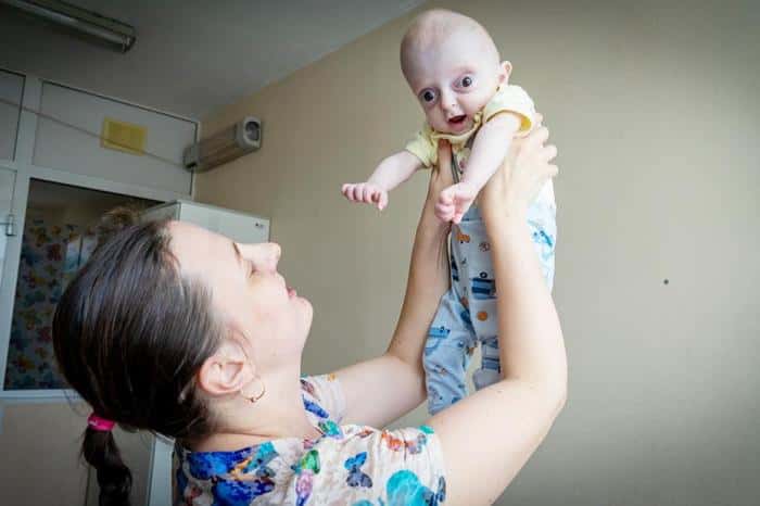 «При рождении остановилось сердце»: мальчик с необычной внешностью родился в Каменске-Уральском