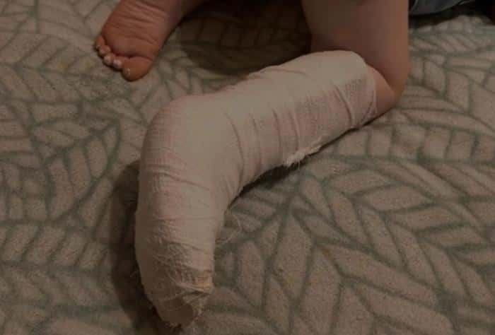 После девяти месяцев молчания: Следком возбудил дело по травме ребенка в детсаду Каменска-Уральского