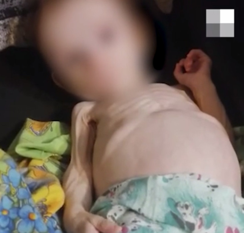 Врачи рассказали о состоянии девочки, которую жительница Урала держала в шкафу