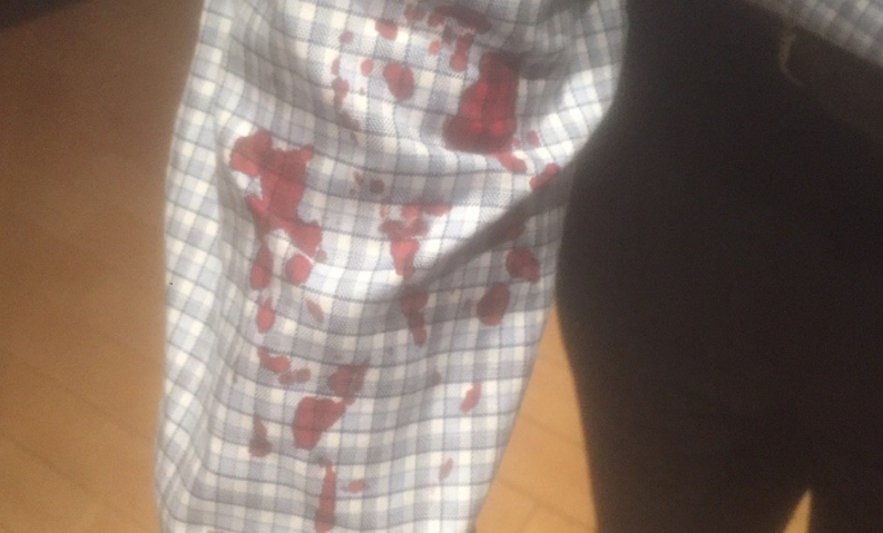 Студент МГУ рассказал, что сотрудники ФСБ два часа резали ему руки, добиваясь признания в терроризме