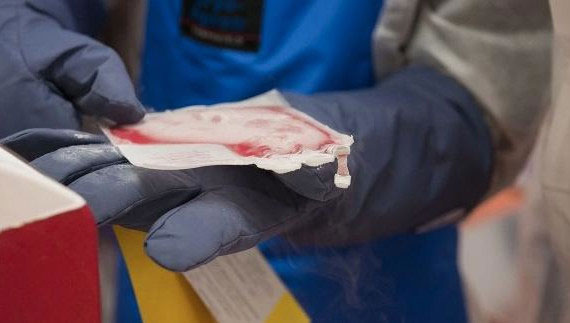 Клеточный препарат от рака за 39 млн рублей впервые зарегистрировали в России