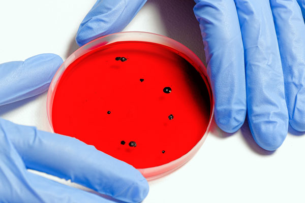 Роспотребнадзор: В России обнаружен южноафриканский штамм коронавируса