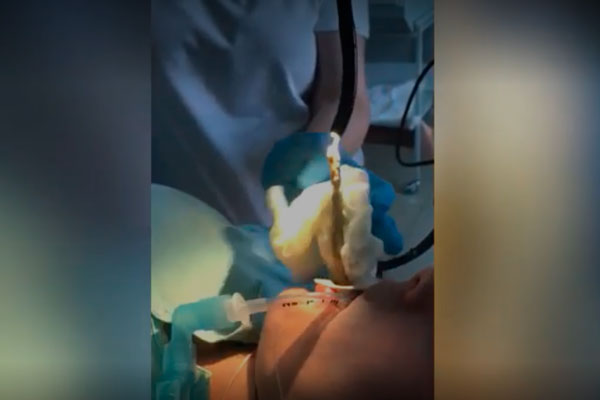 Уснувшей женщине заползла в рот огромная змея