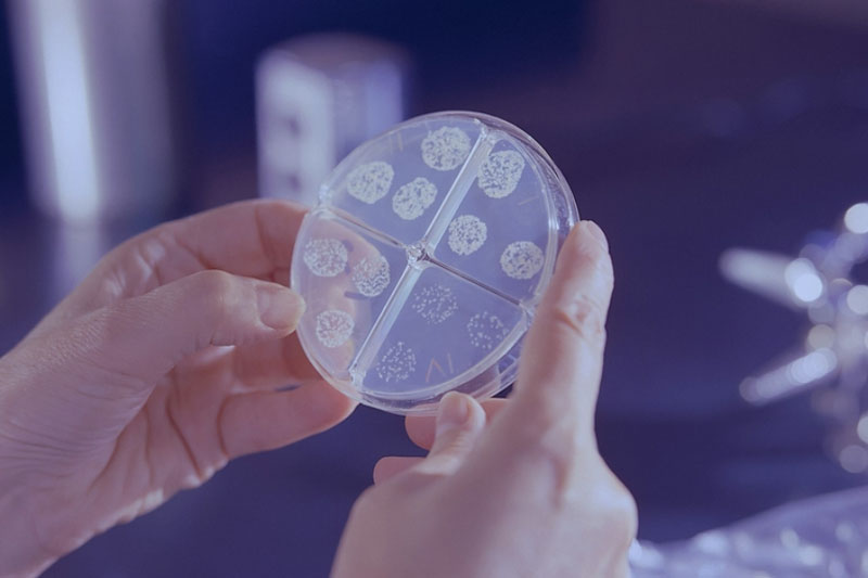 Каменск-Уральский — один из природных очагов туляремии, однако заболевших нет | Роспотребнадзор: Каменск-Уральский — один из природных очагов туляремии