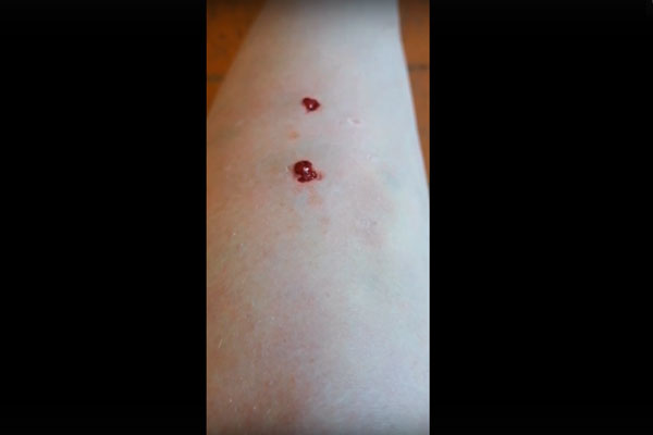 На ул. Строителей в Каменске на прохожую бросилась собака — раны от клыков ужасают! Пострадавшей предстоит курс уколов от бешенства