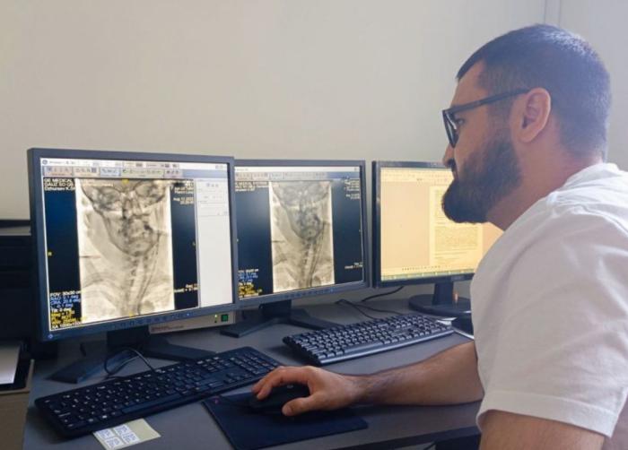 «Буквально пробились к мозгу»: Врачи Каменска-Уральского спасли женщину с инсультом | Врачи Каменска-Уральского чудом спасли женщину с инсультом