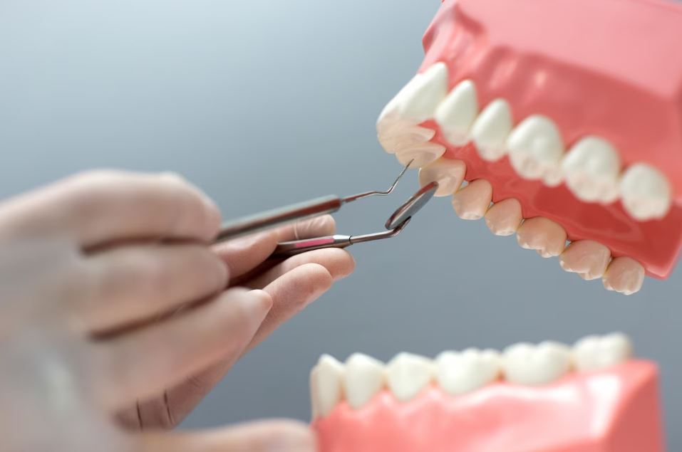 Имплантация зубов