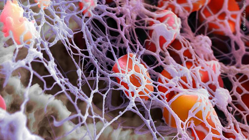 Ученые научились по крови определять тяжесть коронавируса