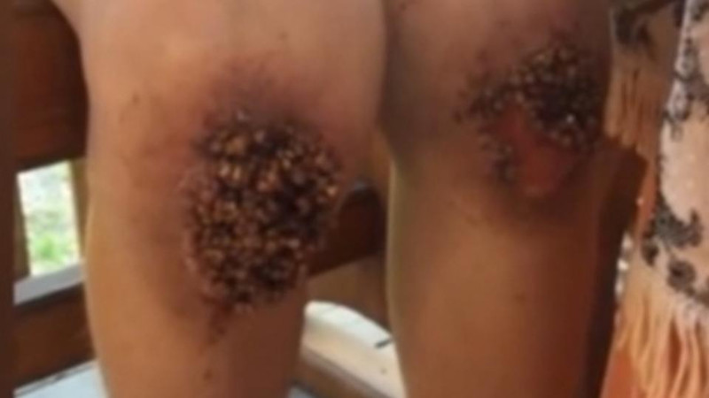 Ребенка из Омска, которого заставляли стоять на гречке, вернули матери