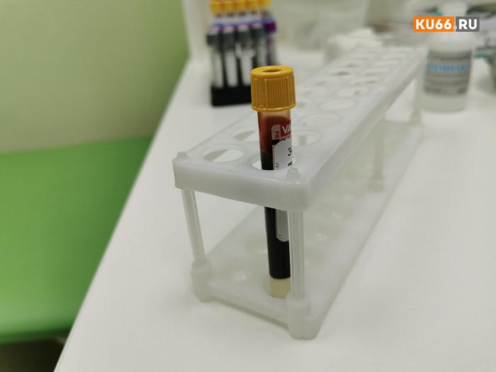 «Вечный яд» в крови человека обнаружили ученые. Что это и как с этим жить? | Nature: в крови человека обнаружили трифторуксусную кислоту