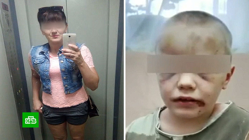 Не умеет говорить и держать ложку: у матери-садистки отобрали истерзанного сына Не умеет говорить и держать ложку: у матери-садистки отобрали истерзанного сына