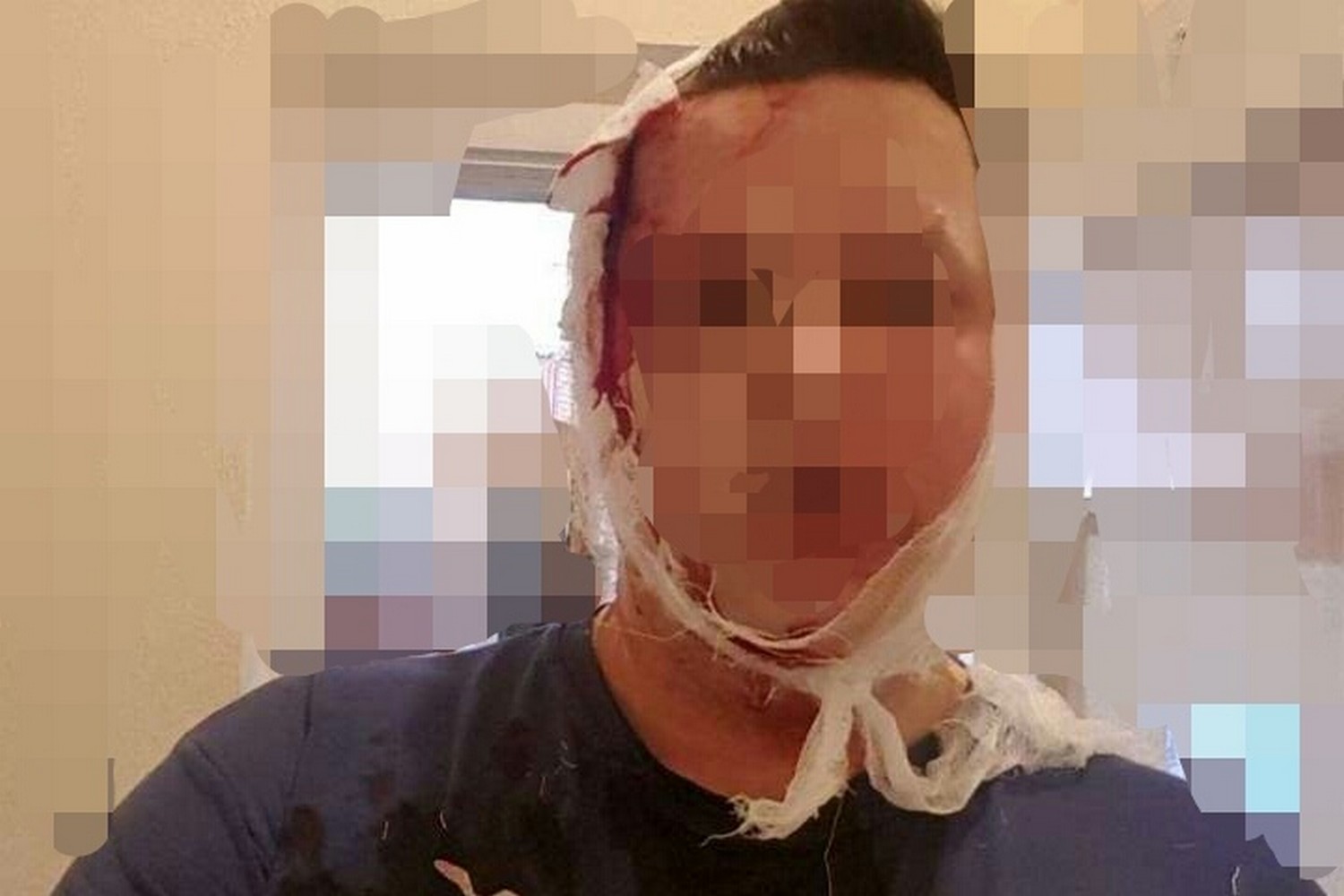 История жителя Каменска, получившего от «грабителей» кружкой пива по голове, оказалась выдумкой. Выяснилось, что правда куда прозаичнее...