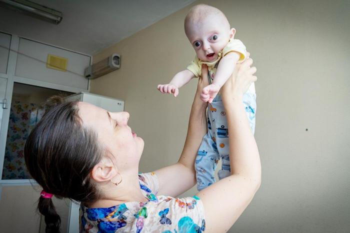 «При рождении остановилось сердце»: мальчик с необычной внешностью родился в Каменске-Уральском | В Каменске-Уральском родился мальчик с синдромом Крузона 