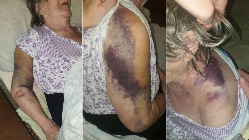 На Урале бабушка заявила, что ее били и привязывали в COVID-больнице На Урале бабушка заявила, что ее били и привязывали в COVID-больнице