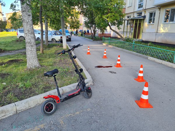 Стало известно о состоянии жительницы Каменска-Уральского, которую сбил электросамокат. ФОТО 