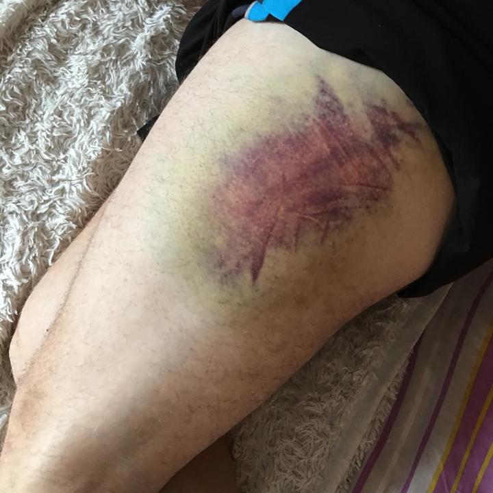 «Ставили ногу на спину»: бывший оперативник обвинил полицейских в жестоком избиении