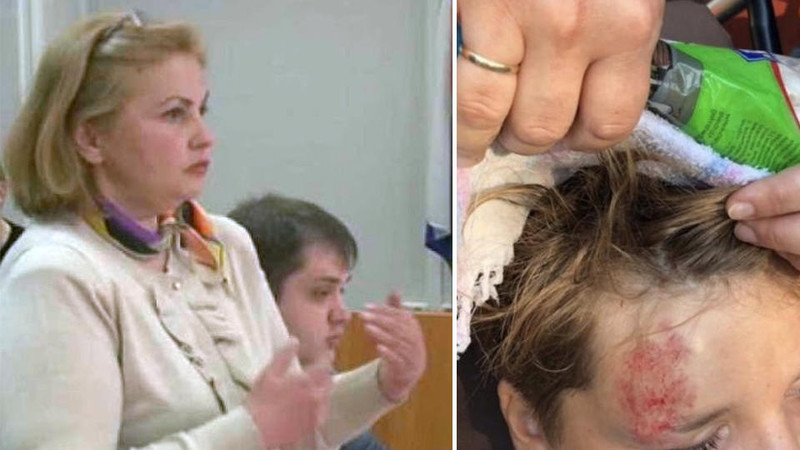 Экс-чиновница сбила ребенка и отсудила у его родителей компенсацию