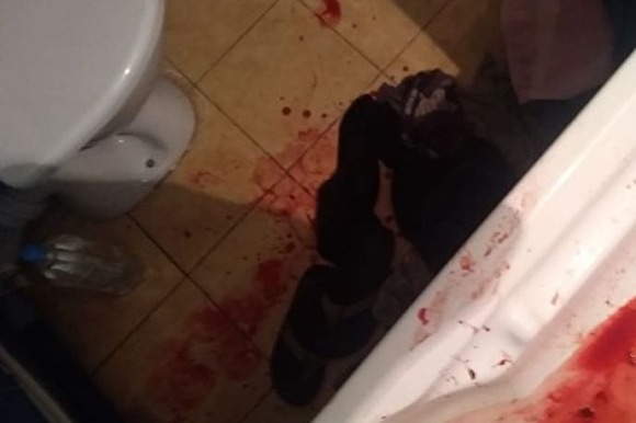 СК проводит проверку из-за смерти журналиста, которому медики останавливали кровотечение курицей