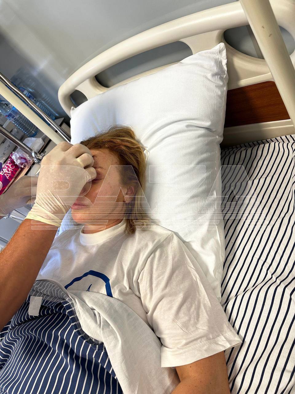 Появились первые фото Лады Дэнс после страшной аварии