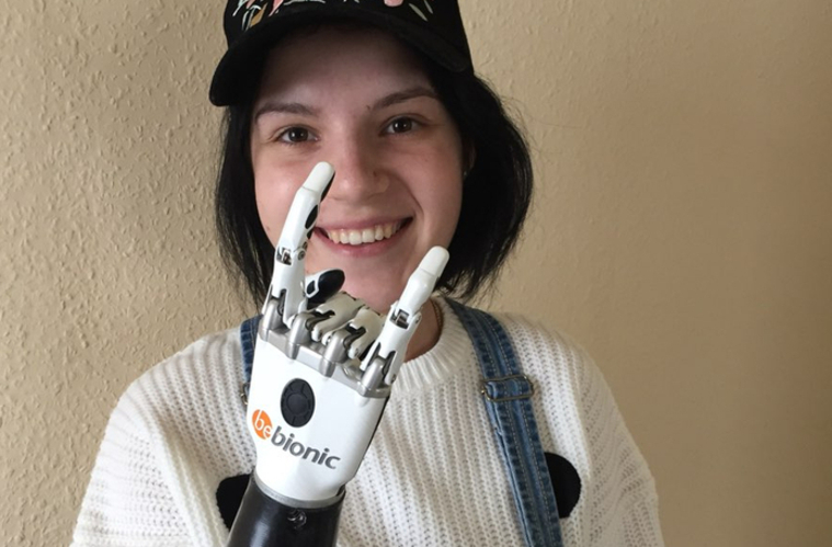 Девушка, которой ревнивый муж отрубил руки, напишет об этом книгу