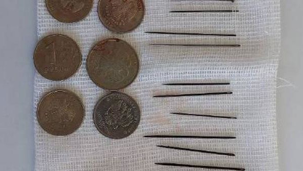 Пенсионерка проглотила монеты, гвозди и иглы