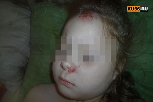 «Ни перил, ни ограждений нет»: семилетняя девочка упала с высоты трех метров, играя во дворе дома в Каменске. Коммунальщики разводят руками