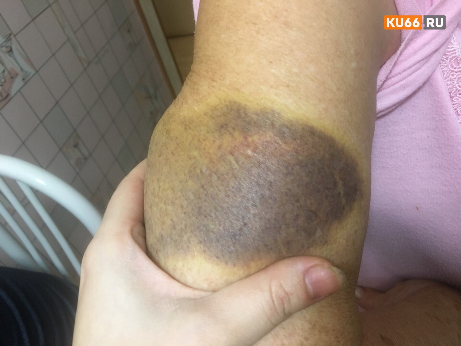 Мужчина, напавший на стариков в Каменске-Уральском, написал встречное заявление. Полицию заверил, что получил пять раз клюкой по голове!