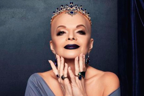 Лариса Долина с лысой головой и в короне поразила Сеть