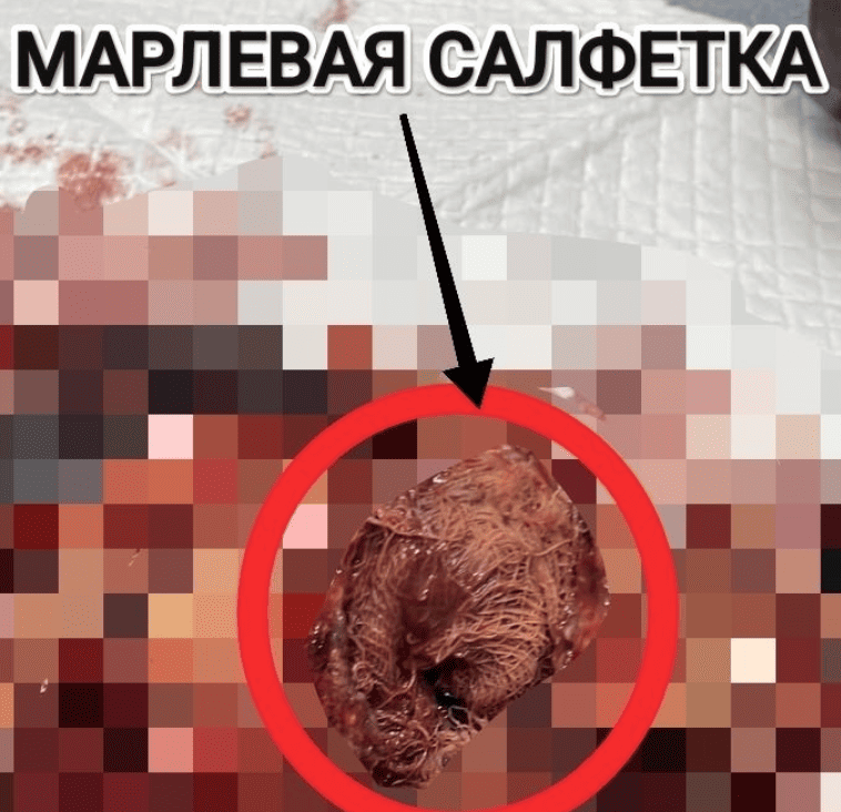 В Каменске-Уральском собака чуть не погибла из-за забытой салфетки после стерилизации | Салфетка в брюшной полости: собака чуть не погибла после стерилизации в Каменске-Уральском