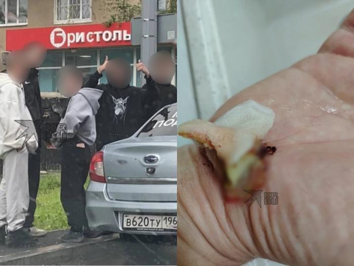 «Похороним тебя в подъезде»: подробности избиения мужчины в Екатеринбурге за отказ дать денег и сигарет | СК завёл дело после нападения подростков на 50-летнего мужчину «Похороним тебя в подъезде»: подробности избиения мужчины в Екатеринбурге за отказ дать денег и сигарет | СК завёл дело после нападения подростков на 50-летнего мужчину