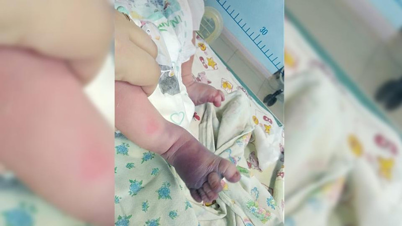 Женщина и ребенок едва не умерли при домашних родах без врача