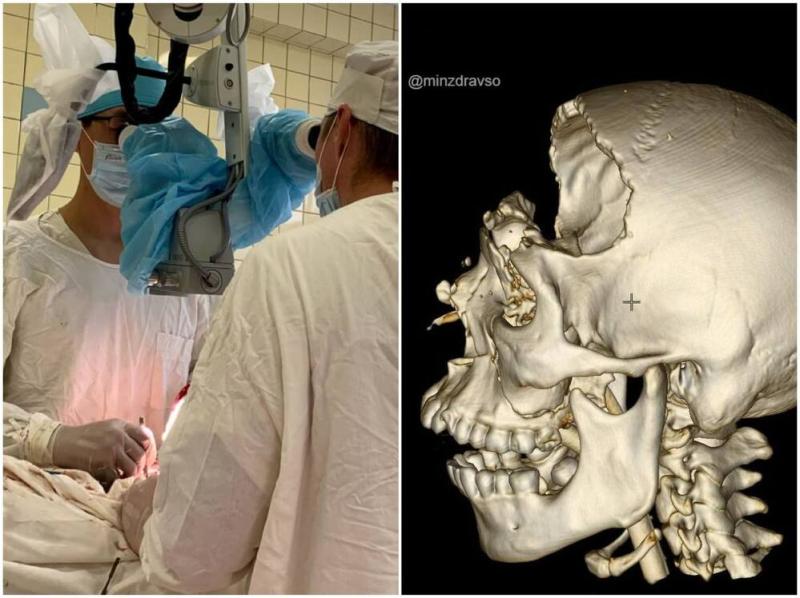 «После страшного ДТП парень едва не погиб»: уральские врачи поставили на ноги пациента с раздробленным черепом | Нейрохирурги Нижнего Тагила спасли 25-летнего уральца с раздробленным черепом