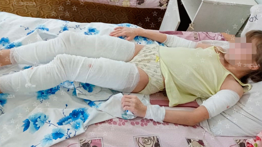 "Снимала вещи с кусками мяса": Под Хабаровском стая собак едва не растерзала 10-летнюю девочку