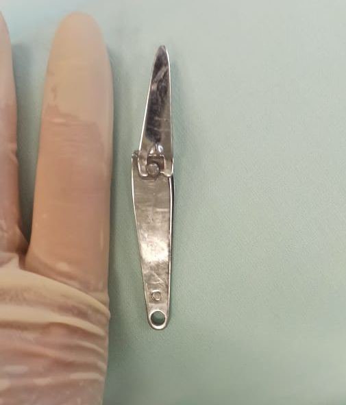 В Уфе врачи вытащили щипцы для стрижки ногтей из желудка шестилетнего ребенка  | Врачи из Уфы достали из желудка ребенка щипцы для стрижки ногтей