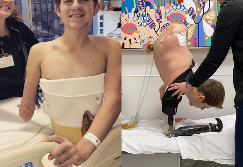 Парень остался без нижней части тела после того, как на него упал 4-тонный погрузчик