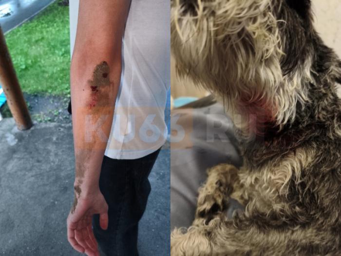 «Наложили шесть швов»: в Каменске-Уральском питбуль напал на подростка и его собаку | В Каменске-Уральском питбуль напал на подростка и его собаку «Наложили шесть швов»: в Каменске-Уральском питбуль напал на подростка и его собаку | В Каменске-Уральском питбуль напал на подростка и его собаку