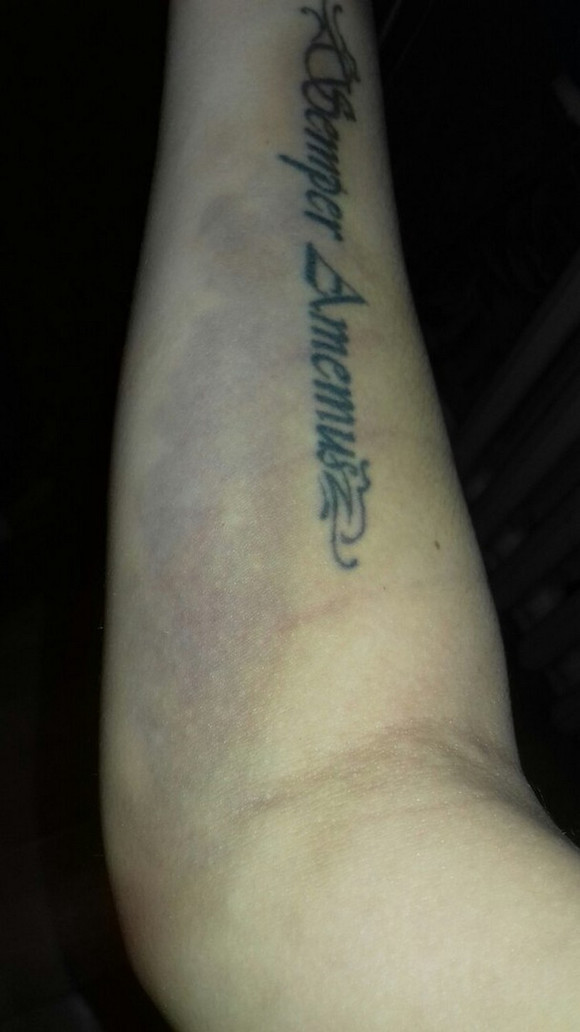 «Рука раздулась и посинела…» В частной клинике Каменска-Уральского девушке прокололи вену, но вместо извинений просто «послали»