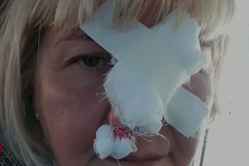 Семью избили на пляже за отказ платить за отдых